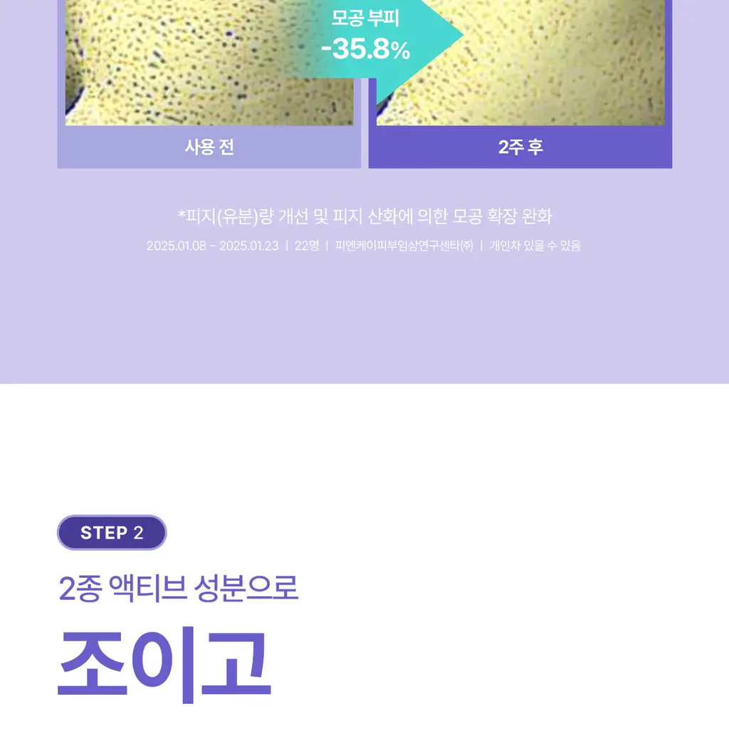 [5월 올영픽/126매 대용량/올리브영 단독] 리쥬란 포어 타이트닝 토너 패드 60매 더블 한정 기획 상세페이지 24